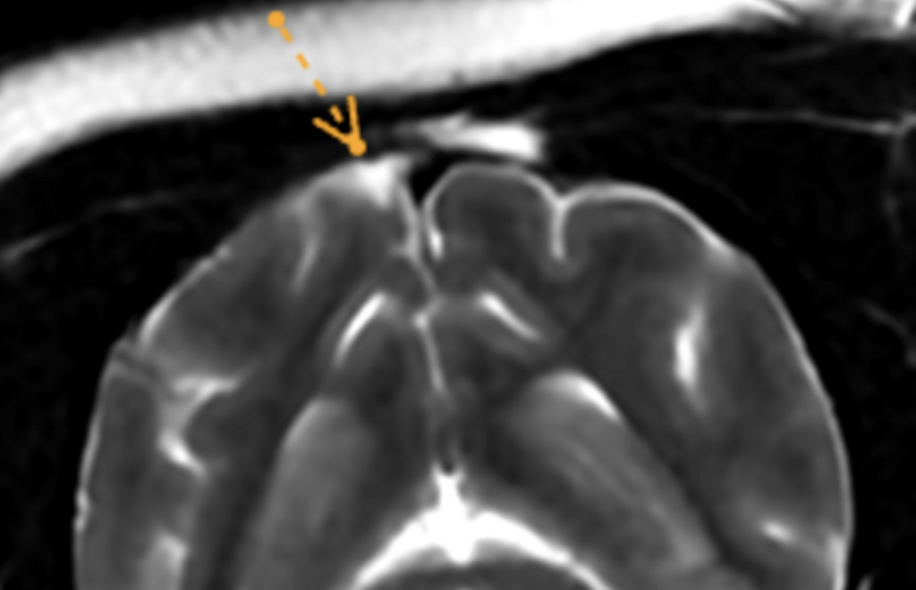 Top Vet Neurological Conditions Identified by Advanced Imaging